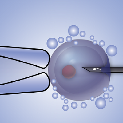 tup-bebek-mikroenjeksiyon-(ICSI)