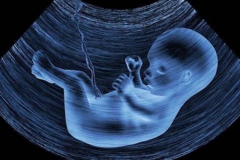 Ultrasonun bebeğe bir zararı var mıdır?