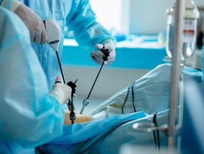 laparoskopik-kapali-cerrahi
