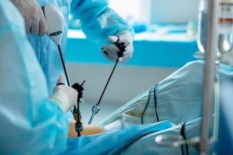 laparoskopik-kapali-cerrahi