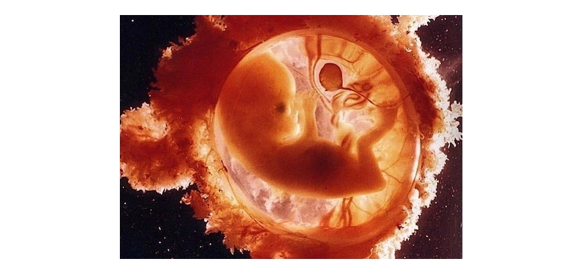Tüp Bebek (IVF) (In Vitro Fertilizasyon) Nedir, Kimlere Uygulanır?